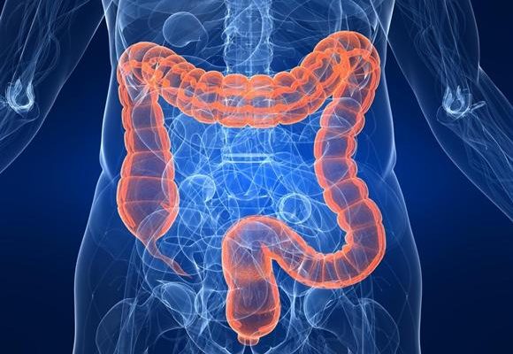 リッキーガット症候群（腸漏れ）にもオメガ３が有効です！